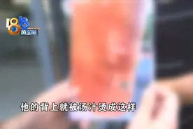 孩子与服务员相撞 后背被菜烫伤图片
