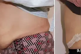 产后肚皮松弛？比心妈妈教你小妙招，拯救大肚皮图片