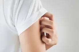 真的有人对“洗澡”过敏？盘点意想不到的荨麻疹诱因图片