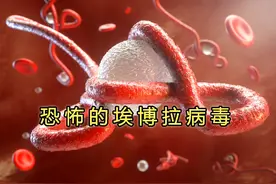 患者七窍流血而死，呕出体内坏死组织，埃博拉病毒为啥这么厉害图片