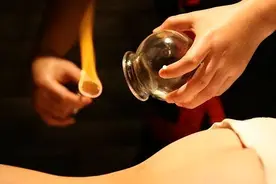 鲜红、淡红、紫黑……拔罐后，不同颜色的罐印代表什么？图片