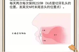 牙医：请把舌头放在该放的位置图片