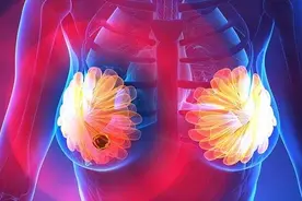 乳腺结节，是气不通，一碗顺气散结汤，化解结节源头图片