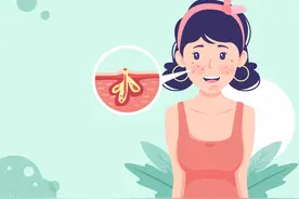 战痘宣颜丨闭口和痘痘，你能分清吗？图片