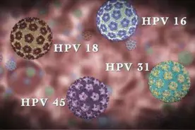 为啥医学发达的日本，却叫停女性接种HPV疫苗呢？本文告诉你真相图片