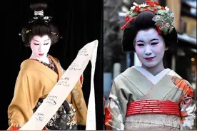 歌舞伎综合征：长得漂亮也是病，这种病产检都查不出来图片