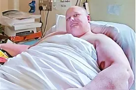 英国男子体重1016斤，女友离开没有工作，医生：死后拉屠宰场火化图片