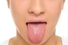 舌头歪了，是大病吗？图片
