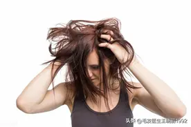 植发效果到底是由什么来判断的？图片
