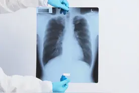 肺部出问题，喉咙先知？医生：喉咙若出现这5个信号，最好别忽视图片