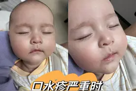 超级实用的宝宝口水疹护理全攻略！记得先收藏起来图片