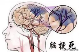 【最新医讯】武夷山市立医院成功完成首例卵圆孔未闭介入封堵术图片