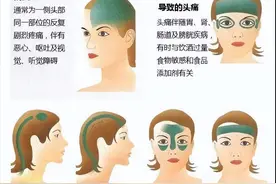 教您两招快速缓解偏头痛图片