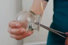 拔火罐吸出来的瘀血，是体内的毒素吗？告诉你真相，看完就知道了图片