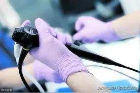 我做无痛胃肠镜的经历图片