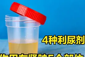 4种利尿剂，作用肾脏部位不同，副作用也不一样！医生全都讲清楚图片