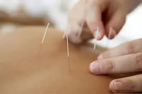 学习针灸都应该了解的“针灸八法”及常见病针灸疗法图片