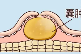 甲状腺结节、乳腺结节注意了！送你一张倪海厦的散结方，横扫顽痰图片