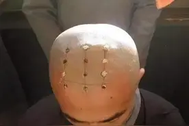 和尚头上的点代表什么意思？是怎么烧出来的？图片