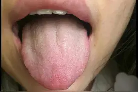 经方治瘖哑图片