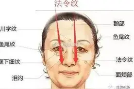 如何消除法令纹图片