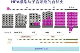 为什么HPV没有特效药？感染了HPV后应该如何治疗？图片