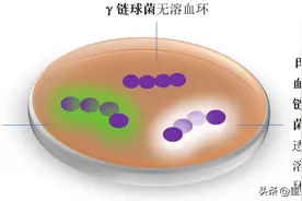 链球菌感染很常见，你至少需要知道这四点！图片