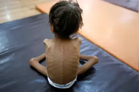 孩子瘦成皮包骨，原来是爷爷长期给孩子吃这些食物，爸爸心都碎了图片