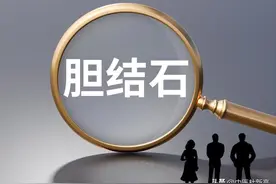 胆结石太大怎么排？中医一招“活血溶石汤”，堪称结石的“克星”图片