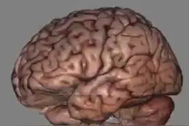 大脑3D解剖及血供3D#3dbody解剖视频封面