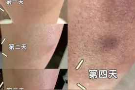 紧急提醒！浙江已出现，千万别碰图片