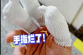 男子三根手指被腐蚀成黑洞…警惕！千万不要心存侥幸图片