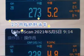 减重30斤的他，好身材保持了4年，肥胖门诊拯救“脆皮”打工人图片