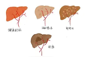 追求乙肝功能性治愈，奉贤区古华医院提供个性化治疗方案→图片