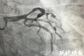 睡梦中被“憋”醒，男子疏于控制血压突发心梗图片