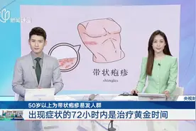 50岁以上为带状疱疹易发人群 出现症状的72小时内是治疗黄金时间图片