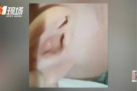 揪心！1岁半宝宝掏耳，戳出脑脊液……图片
