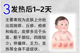 又到水痘高发季，成人感染更厉害！水痘这事儿，长大还要“续约”？图片