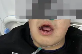 陕西一男子在业主群“吐槽”物业，遭数人上门连扇嘴巴？警方介入调查图片