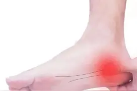 教你5招，有效缓解脚后跟疼痛图片