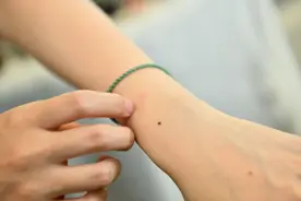 身体出现这4个迹象，提醒你免疫力下降了，赶紧对照一下！图片