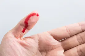 洗小龙虾时大拇指被扎，杭州男子多脏器衰竭不幸离世！一个小伤口，为何会致命？图片