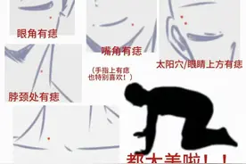 可能癌变！发现身上有这种痣必须立即处理，迅速自查！图片