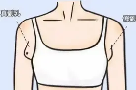 美容院里消除副乳？实话说，不靠谱！图片