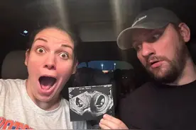 5000万分之一的几率！美国32岁女子双子宫同时怀胎，平躺时孕肚正中还会凹陷图片