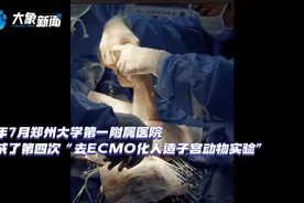 男性“怀孕”或成现实？世界首例去ECMO人造子宫成功图片