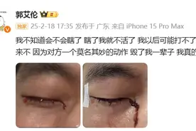 意外受伤，眼睛里缝了40多针！知名运动员发声：以后可能打不了篮球图片