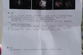 宝宝反复剧烈呕吐 要警惕这种先天性疾病图片