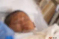 11岁男孩严重烧伤，潍坊坊子美协将进行书画义拍筹集善款图片