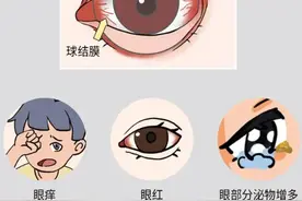 岐黄名医说丨中医话“时复目痒”图片